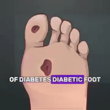 SockerKontroll™ | Massageolja för diabetes