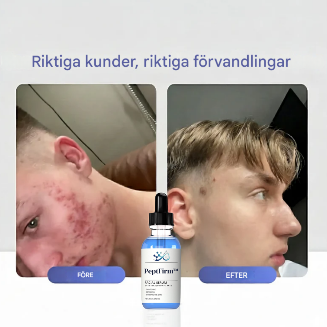 PeptFirm™ | Akneserum