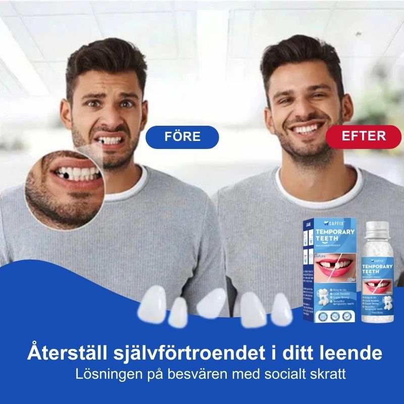 GapFix™ | Temporär Tandformnings- och Reparationskit