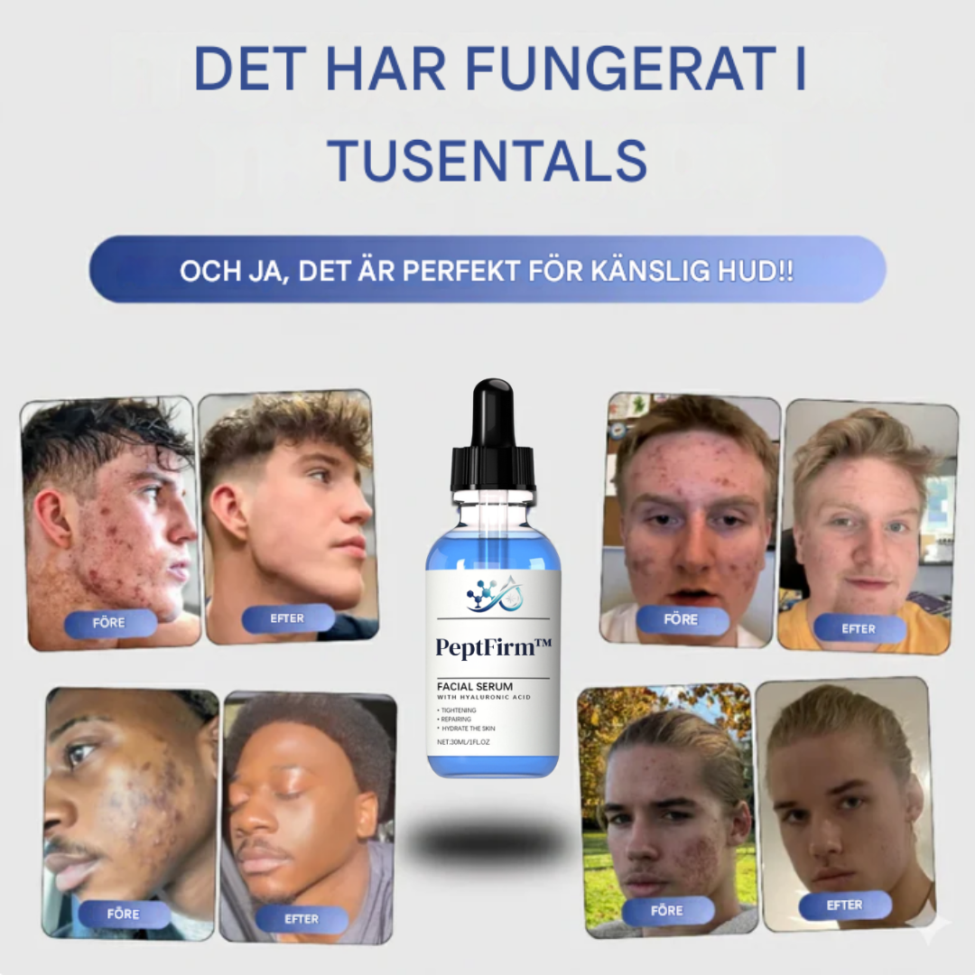 PeptFirm™ | Akneserum