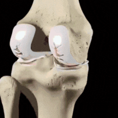 ArthroEase® | Naturlig lindring för artrossmärta