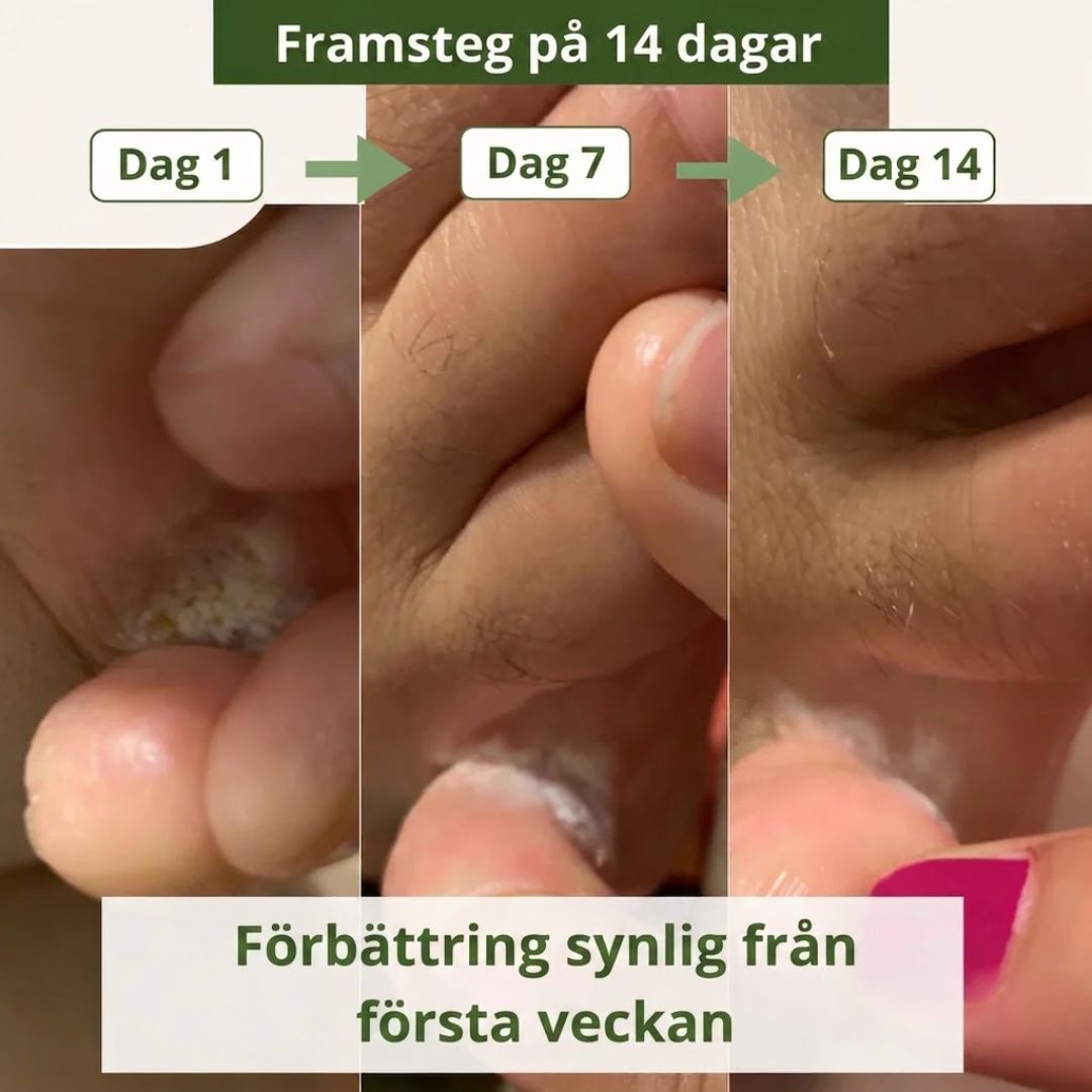 DermaGuard™ | Svampdödande tvål