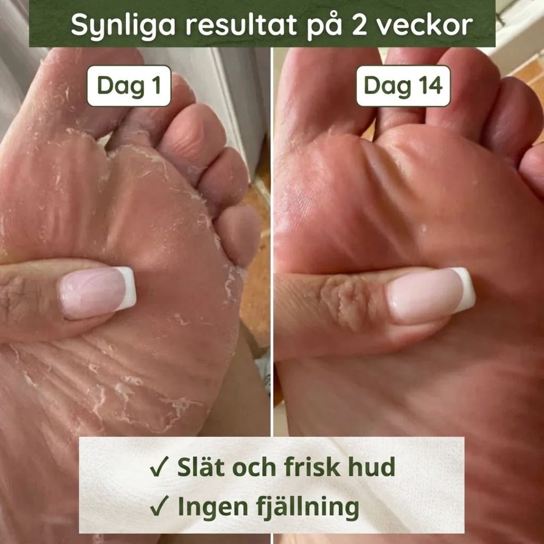 DermaGuard™ | Svampdödande tvål