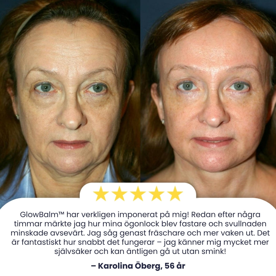 GlowBalm™ | Nyponögonbalsam