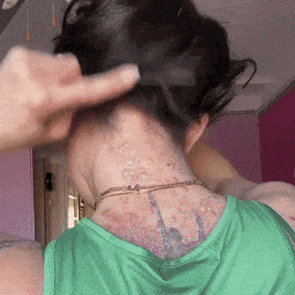 KrokoDerma™ | Krokodiloljetvål för psoriasis och eksem