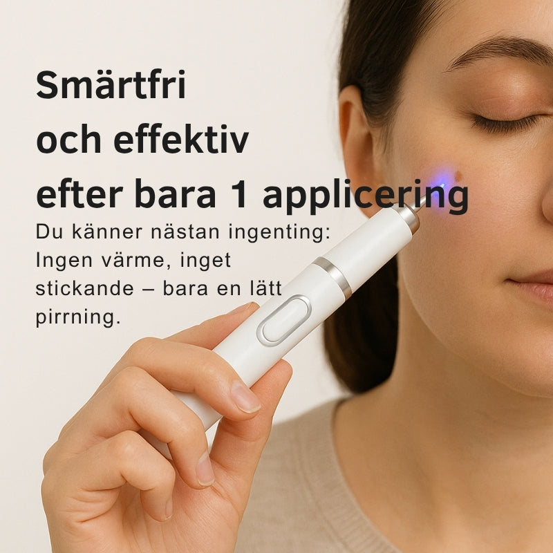 LaserPen™ | Precis Plasma-Hudkorrektor Pen