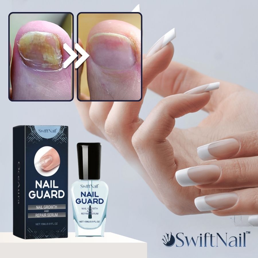 SwiftNail™ | Nagelreparationsserum