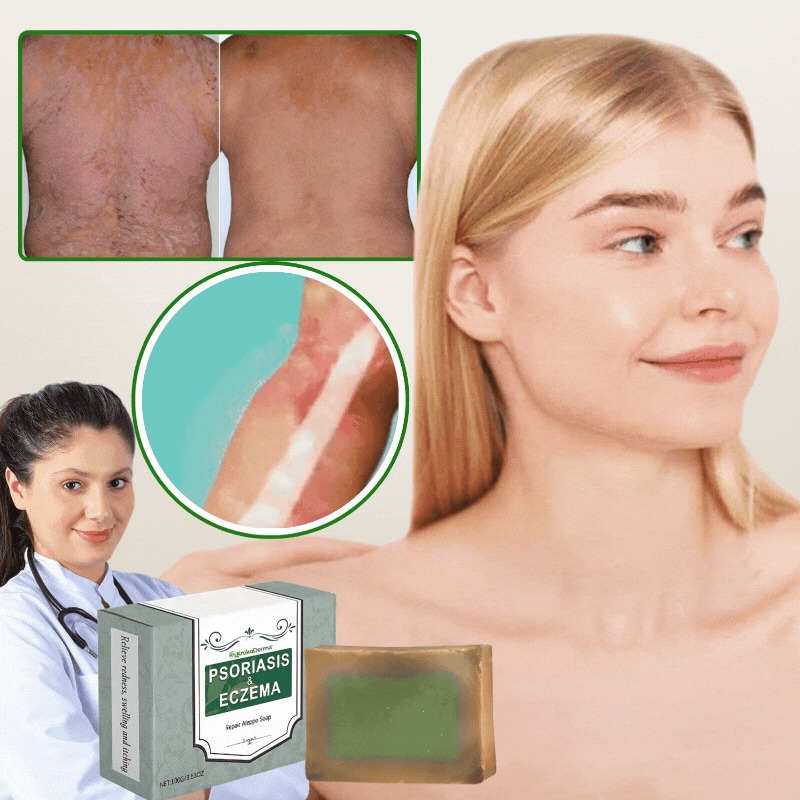KrokoDerma™ | Krokodiloljetvål för psoriasis och eksem