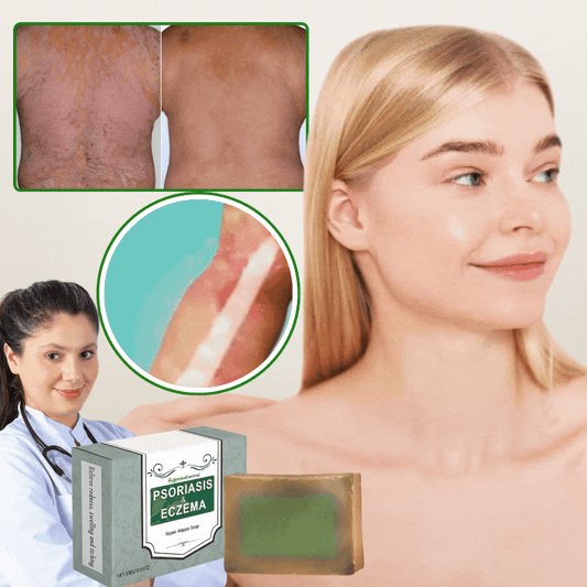 KrokoDerma™ | Krokodiloljetvål för psoriasis och eksem