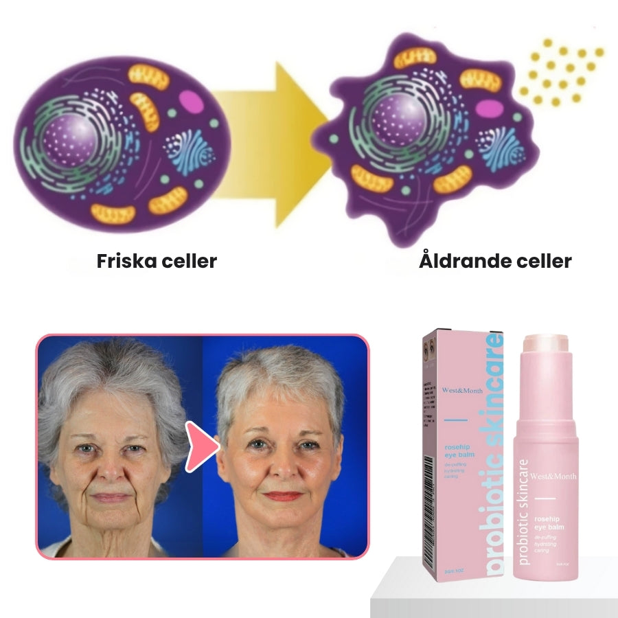 GlowBalm™ | Nyponögonbalsam