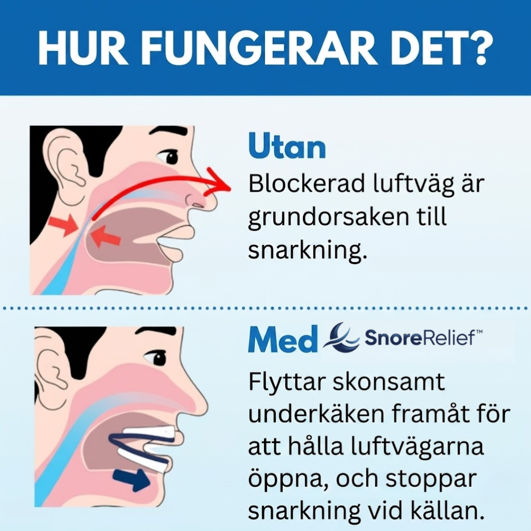 SnoreRelief™ | Anti-snarkningsmunstycke