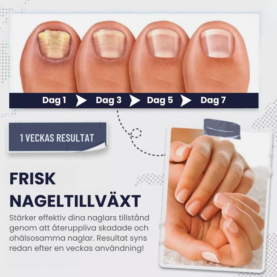 SwiftNail™ | Nagelreparationsserum