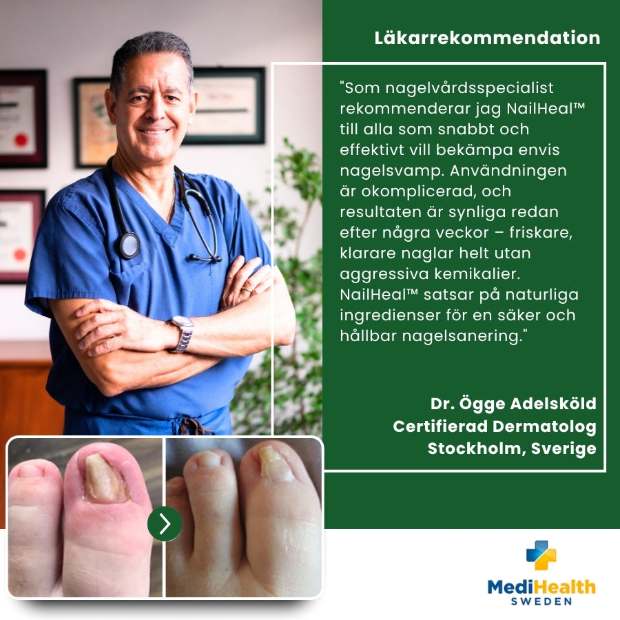 NailHeal™ | Ört-Nagel-Förnyelse-Spray