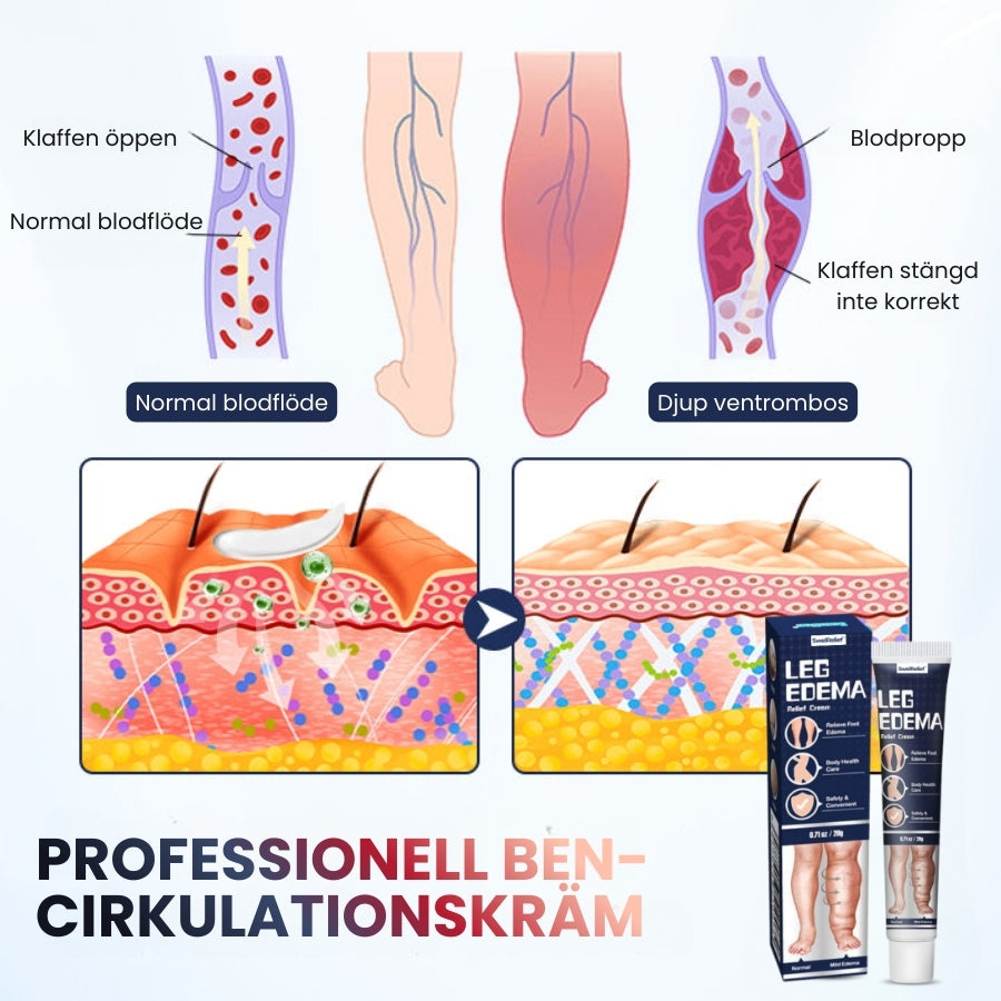 SwelRelief™ | Kräm för lindring av bensvullnad