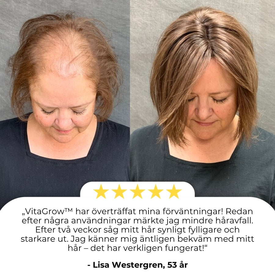 VitaGrow™ | Biotin Hårväxtspray