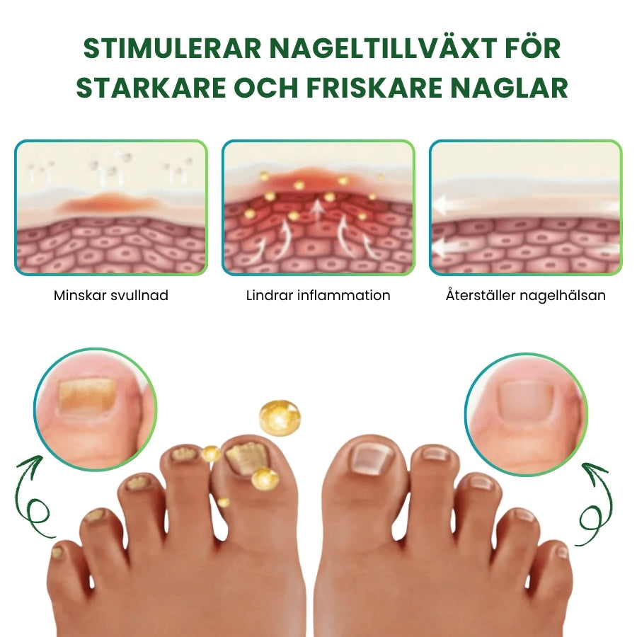 NailHeal™ | Ört-Nagel-Förnyelse-Spray