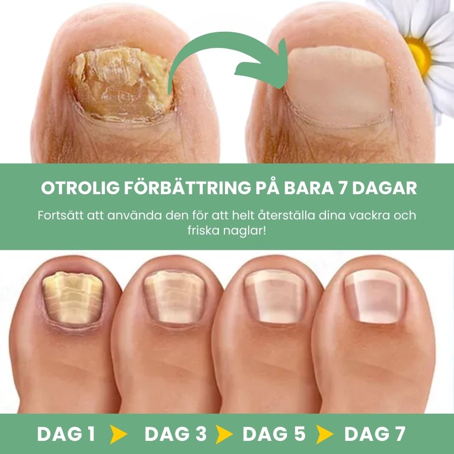 FungBoost™ | Gel för behandling av nagelsvamp