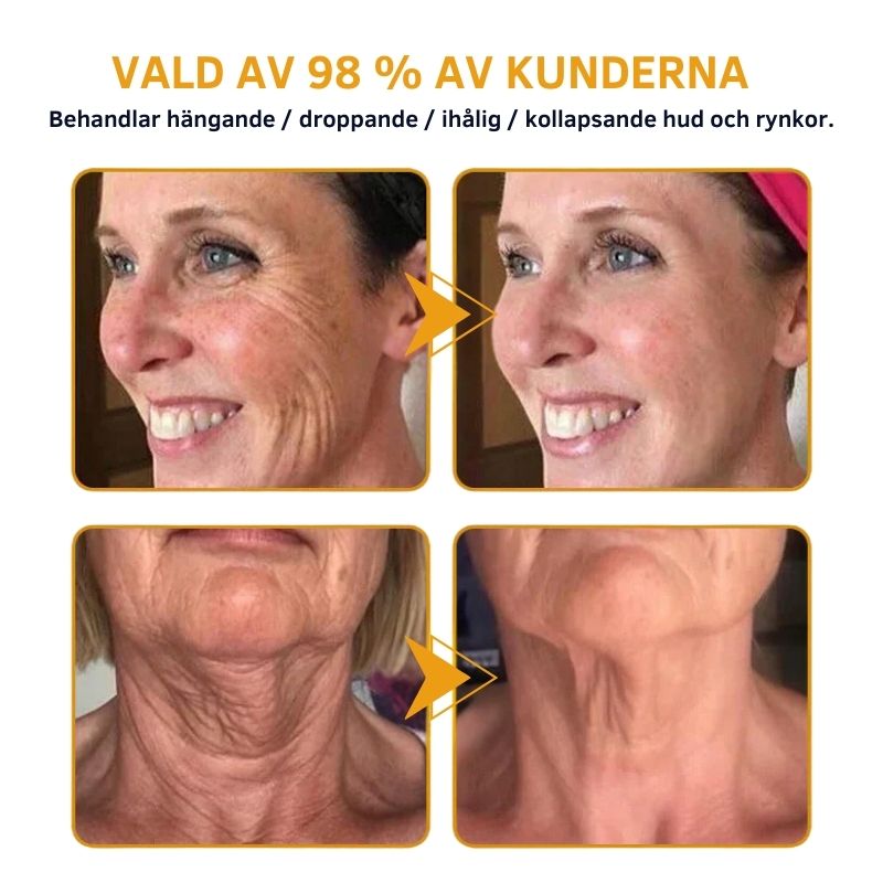 ÅlderDefy™ | Rynkavlägsnande Kräm
