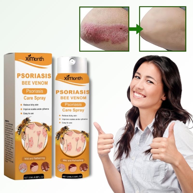 PsoriKlar™ | Eliminerar psoriasis med 92 % på 48 timmar