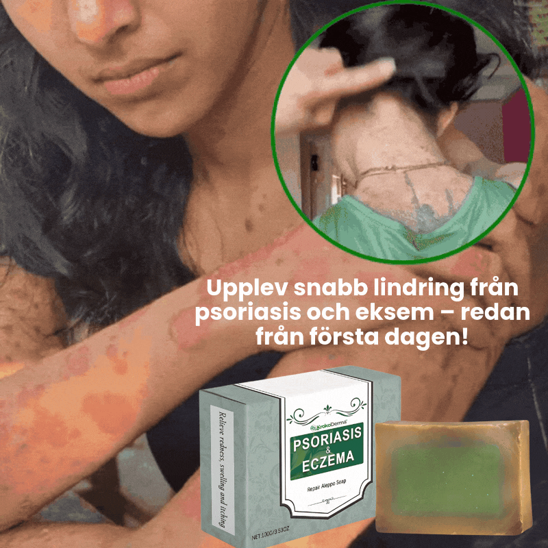 KrokoDerma™ | Krokodiloljetvål för psoriasis och eksem