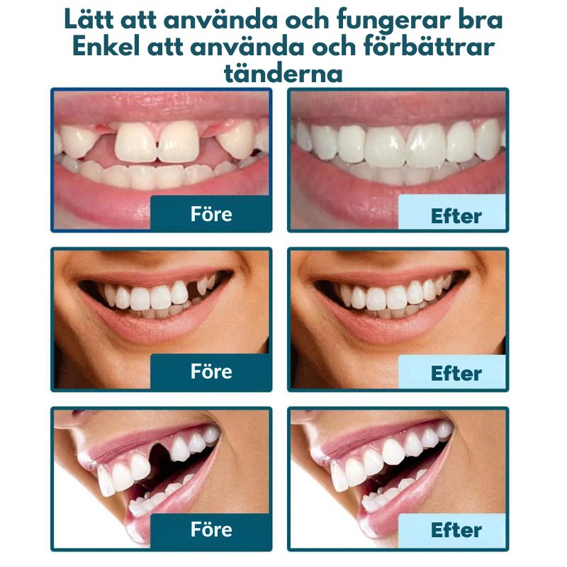 TandVård™ | Le utan bekymmer på bara 1 sekund!