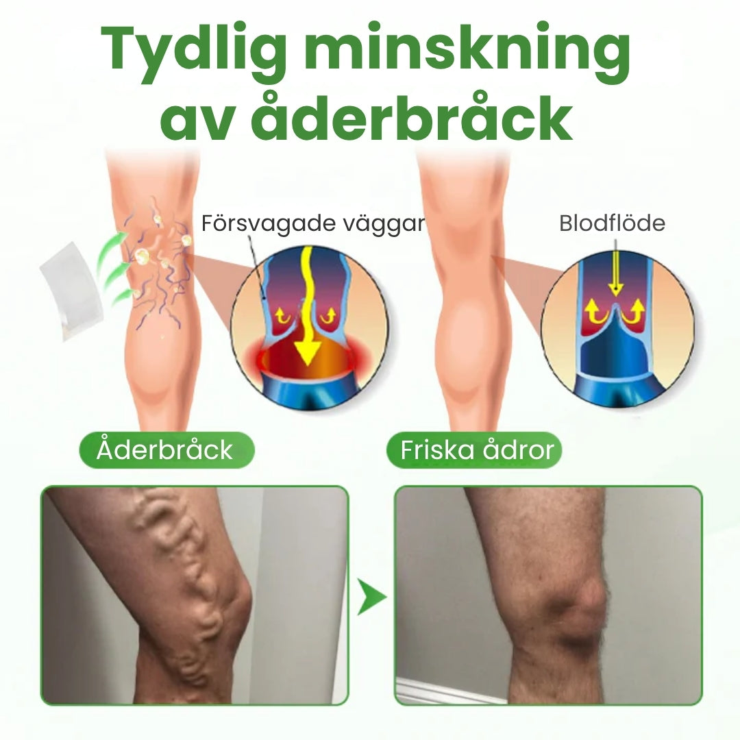 VeinHeal™ | Mikronålsplåstret som ger dina ben livet tillbaka