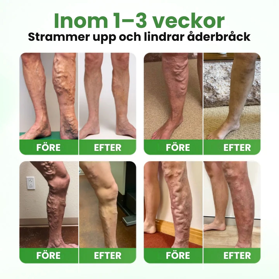 VeinHeal™ | Mikronålsplåstret som ger dina ben livet tillbaka