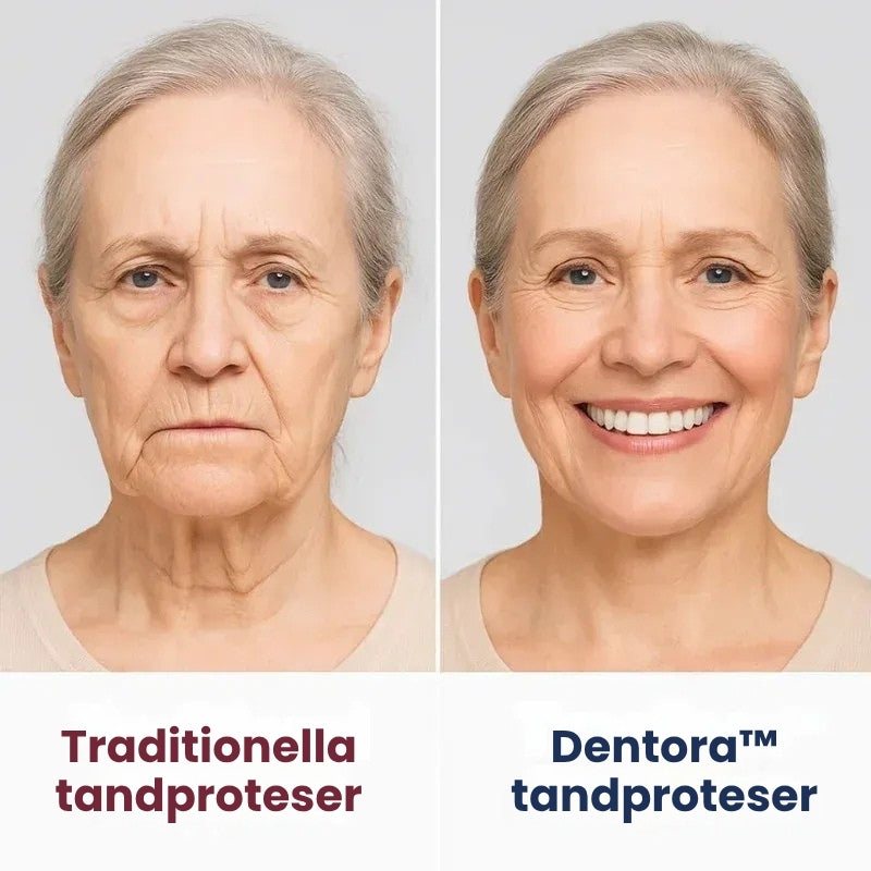 Dentora™ | Omedelbar tandprotes