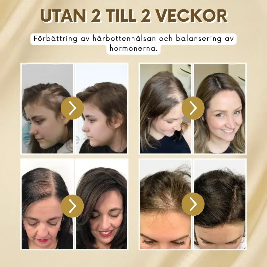 VitaGrow™ | Biotin Hårväxtspray