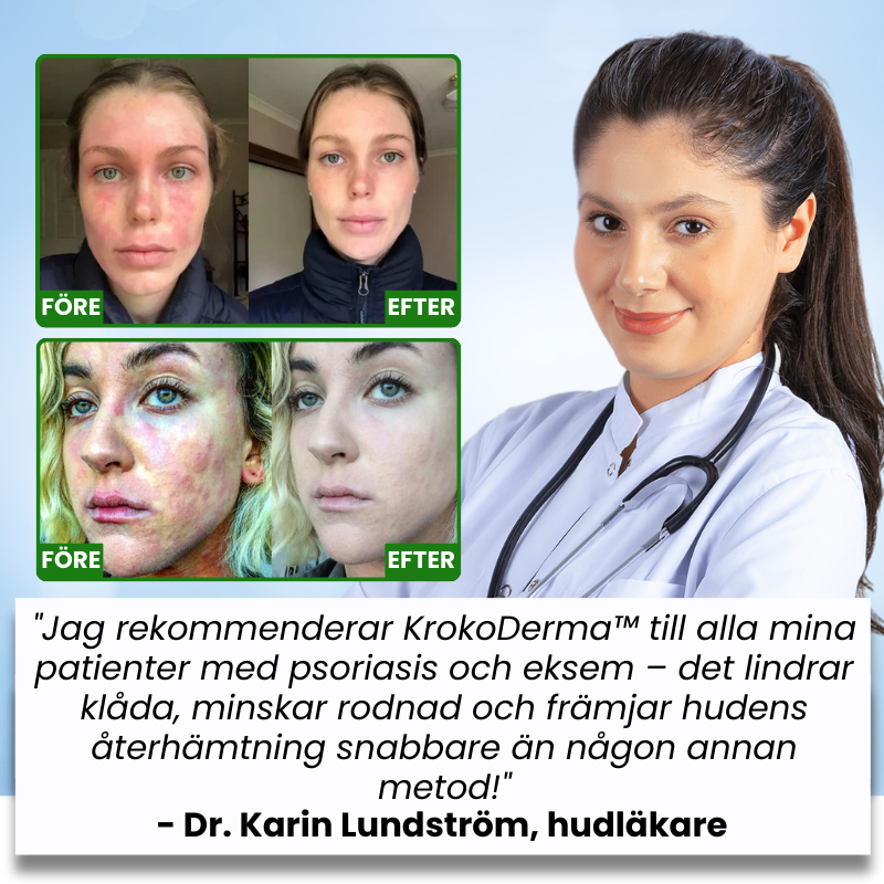 KrokoDerma™ | Krokodiloljetvål för psoriasis och eksem
