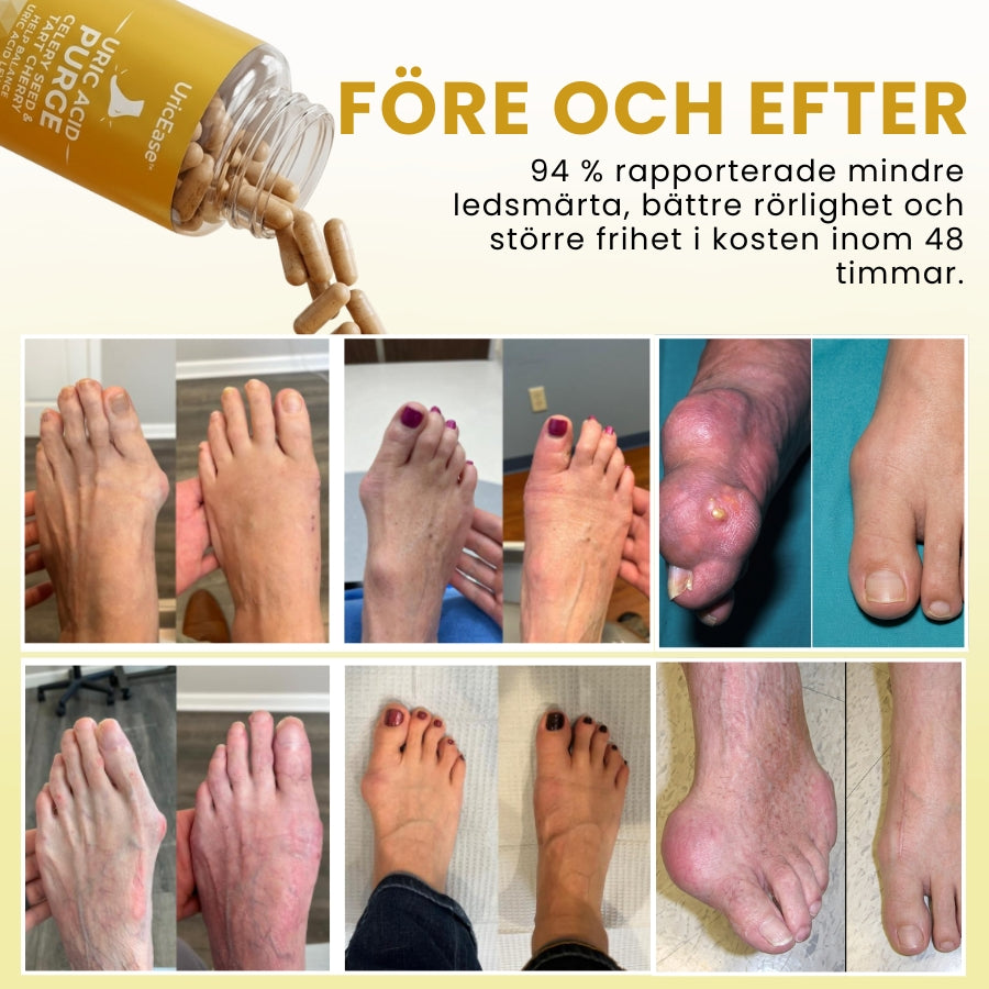 UricEase™ | Formel för skydd mot urinsyra