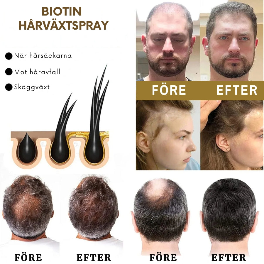 VitaGrow™ | Biotin Hårväxtspray