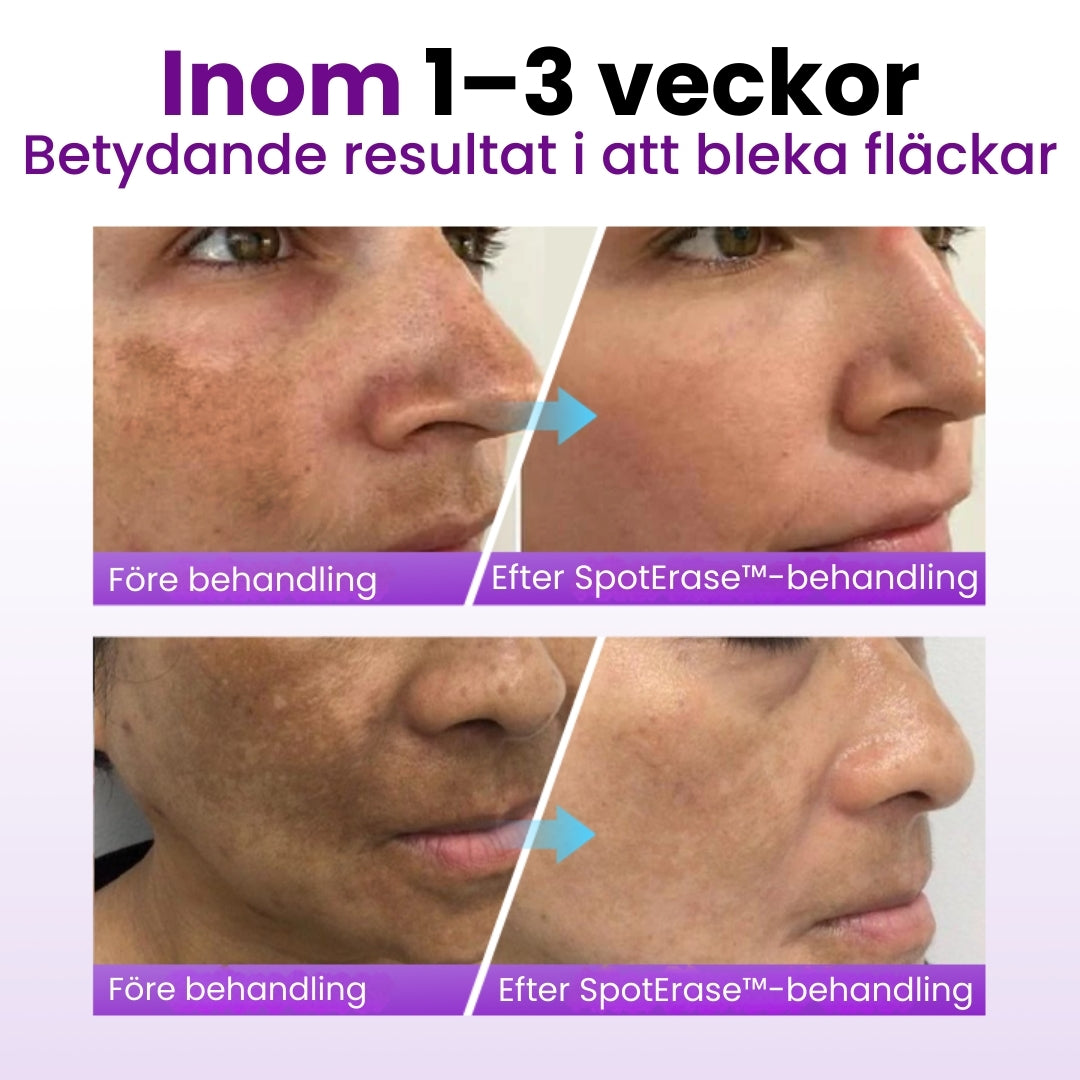 SpotErase™ | Djupvård för ansiktet