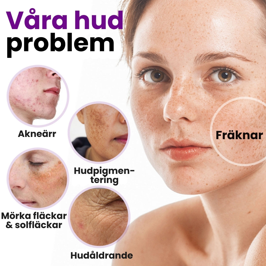 SpotErase™ | Djupvård för ansiktet