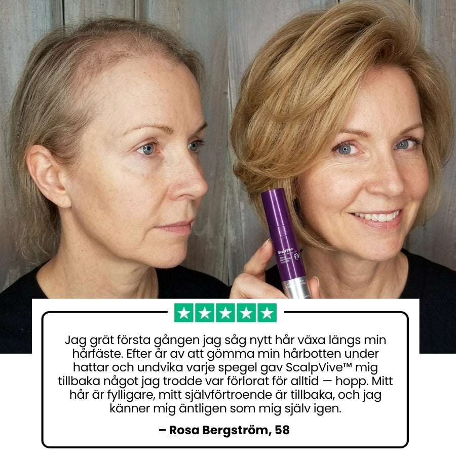 ScalpVive™ | Hårbottenrevitaliserande lösning