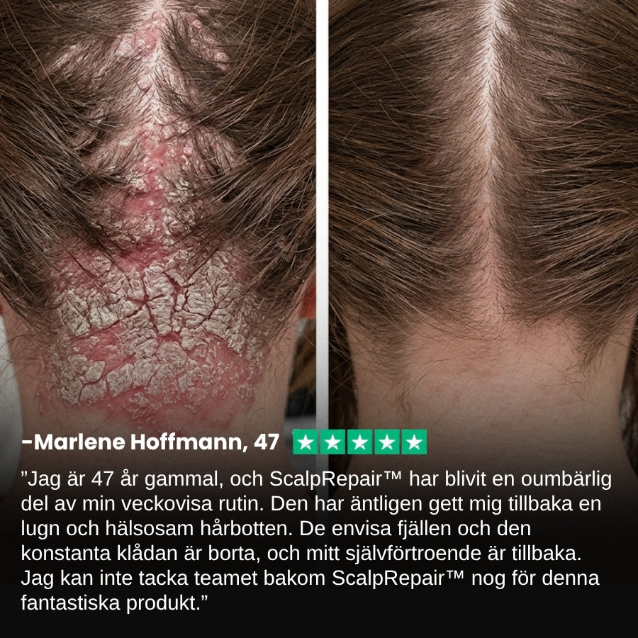 ScalpRepair™ | Skonsam hårbottenpeeling