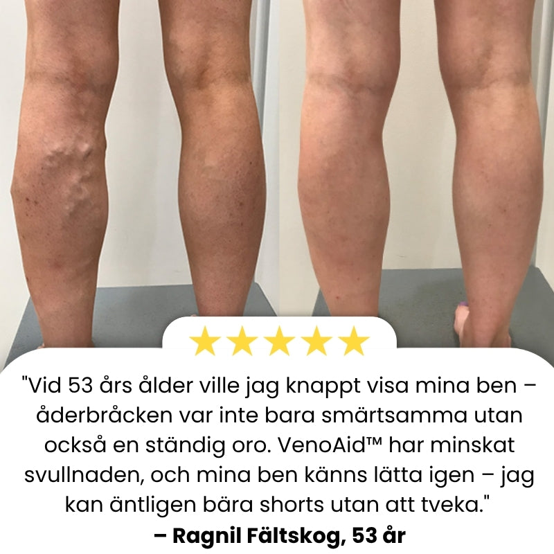 VenoAid™ | Åderbråckslösning Spray