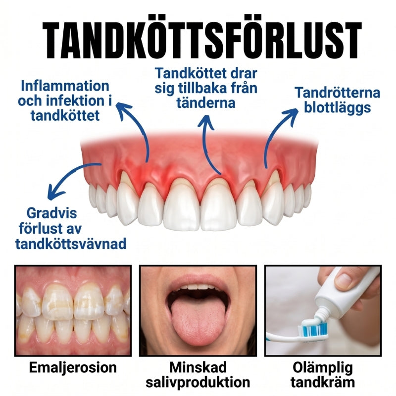 Balancia™ | Bigift mot tandköttsförlust