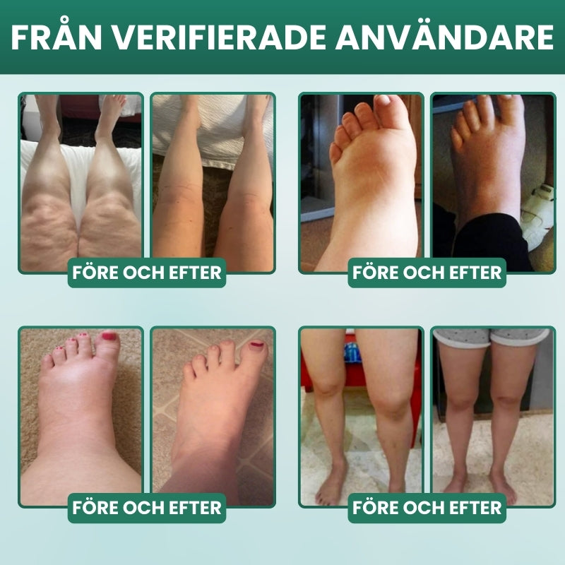 Lymphoria™ | Wellness-droppar för lymfdränering
