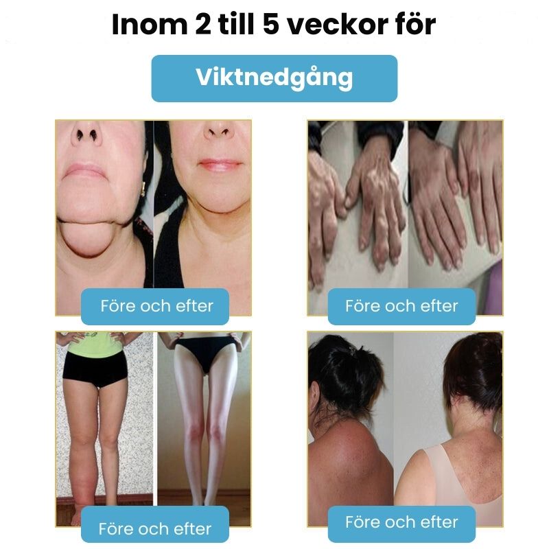 SlimPuls™ | Ultraljuds-Detox-Armband för Fettförbränning & Blodsockerreglering