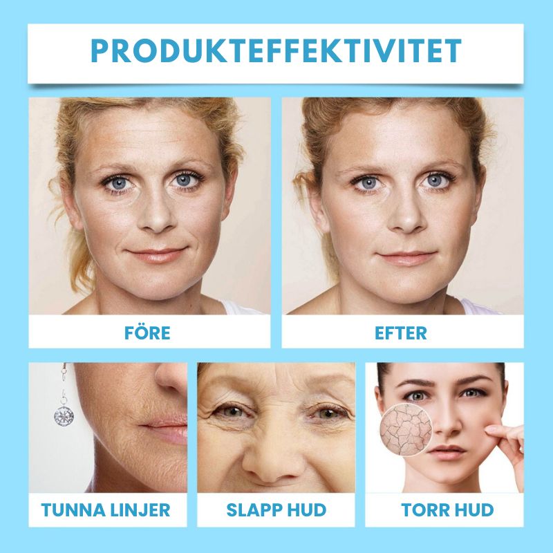 SlätHud™ | Upplev ditt ungdomliga utseende på nytt på bara 5 dagar!