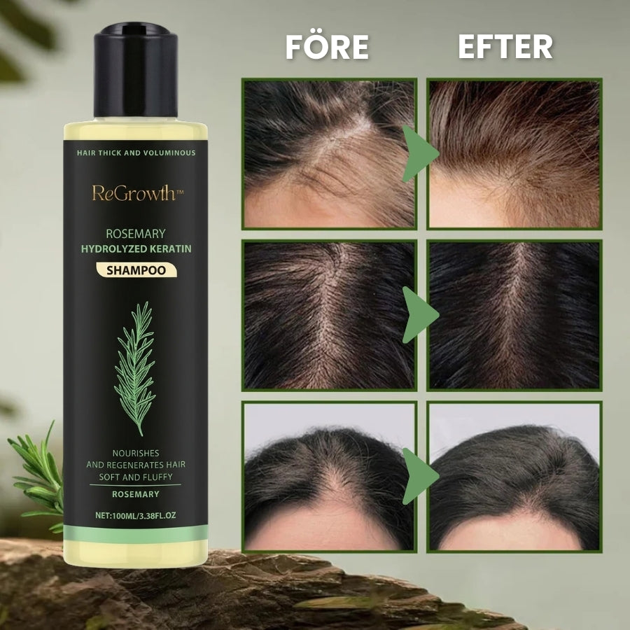 ReGrowth™ | Ekologiskt Rosmarinshampo för Hårväxt
