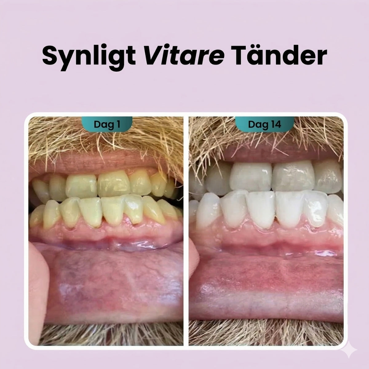 EnamelRevive™ | Hydroxyapatit Tandkräm
