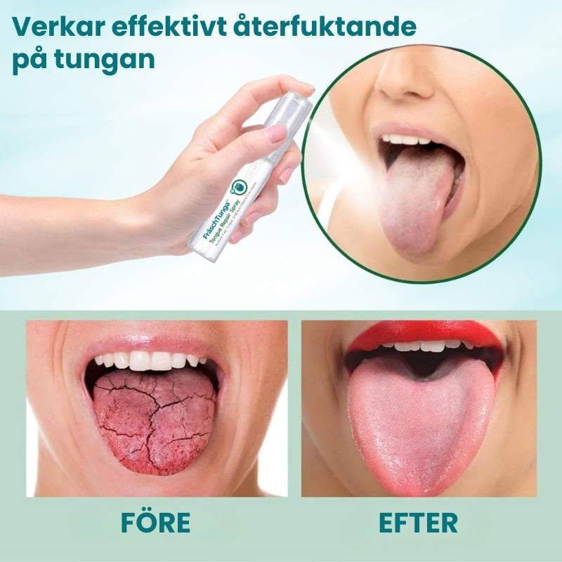 FräschTunga™ | Tunge Reparationsspray