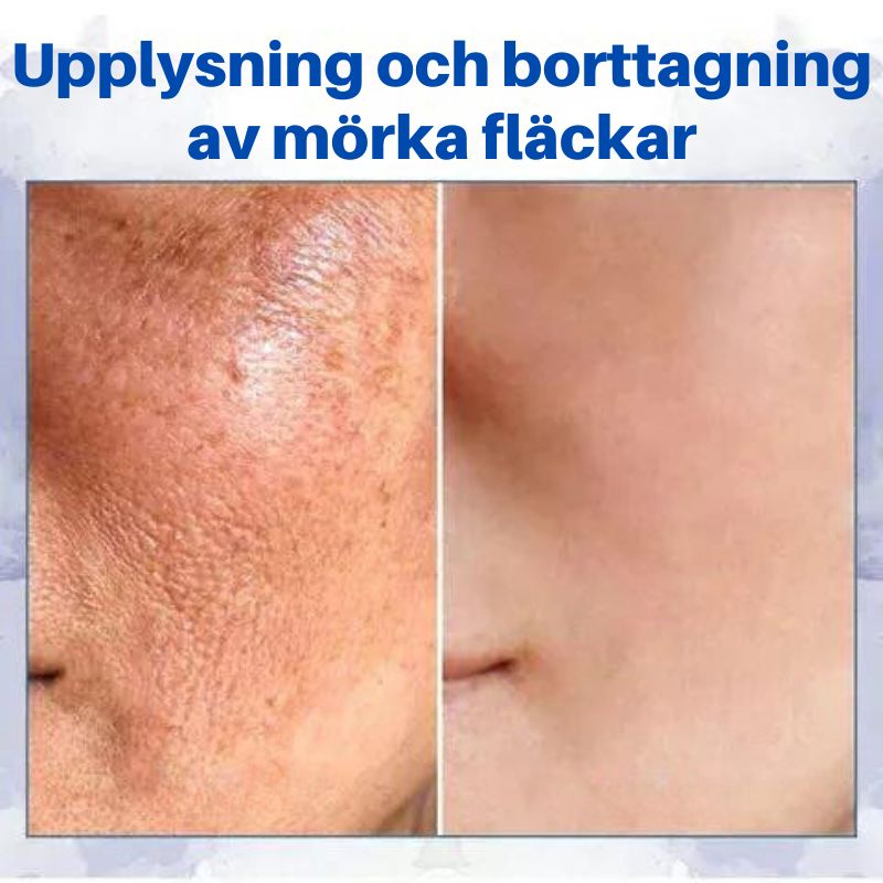 RynkFri™ | Avancerad uppstramande & rynkreducerande kräm på bara 7 dagar!