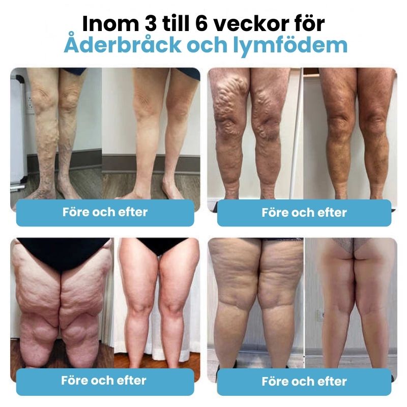 SlimPuls™ | Ultraljuds-Detox-Armband för Fettförbränning & Blodsockerreglering