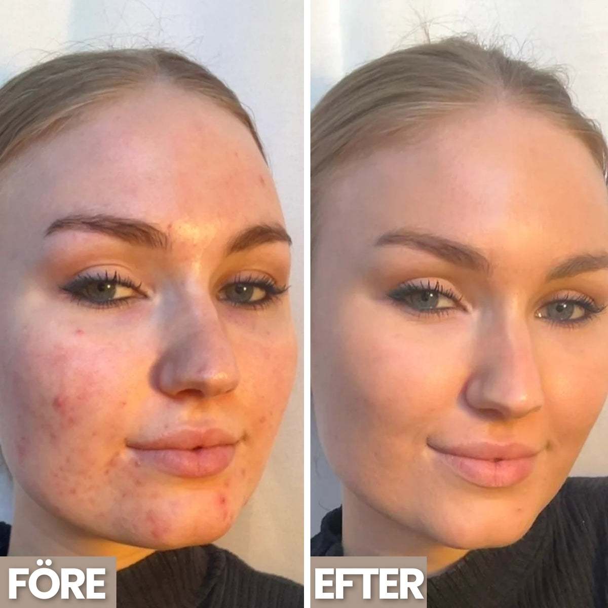 RealGlow™ | GG Kräm Kollagen-Edition