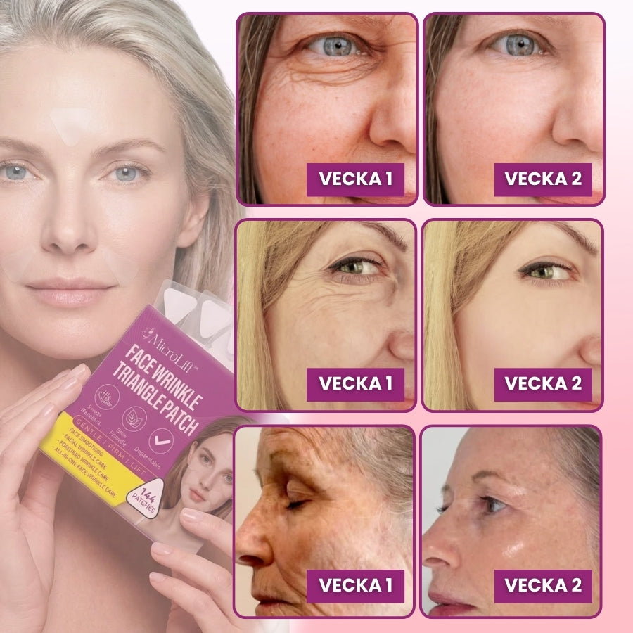 MicroLift™ | Anti-aging-plåster