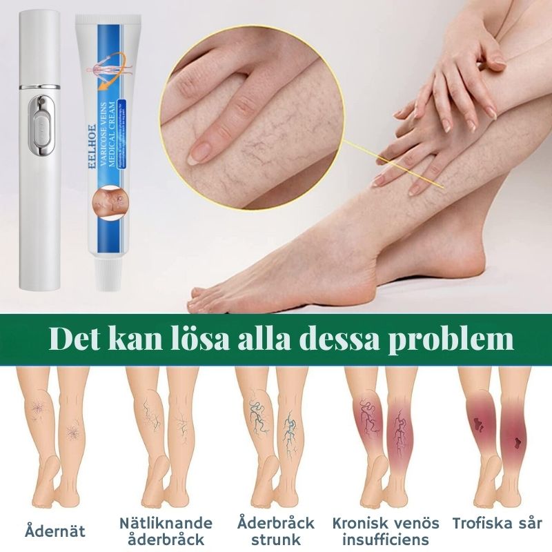 ÅderbråckKlar™ | Fullständig eliminering av åderbråck på bara 4 veckor!