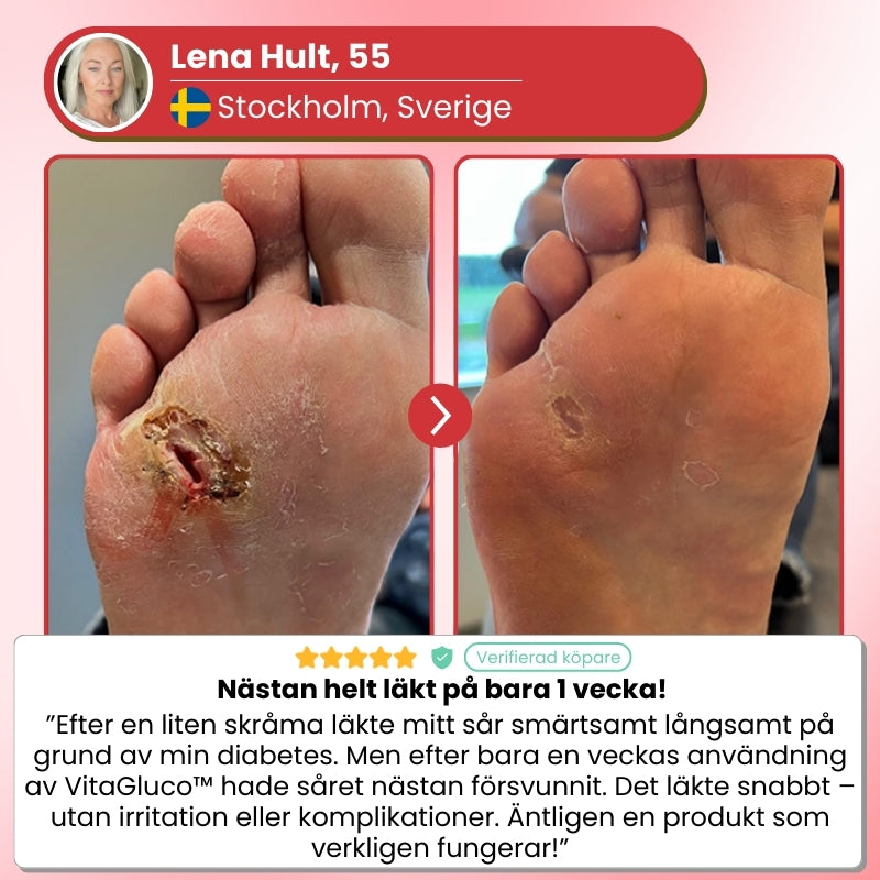 VitaGluco™ | Diabetisk Sårvårdskräm